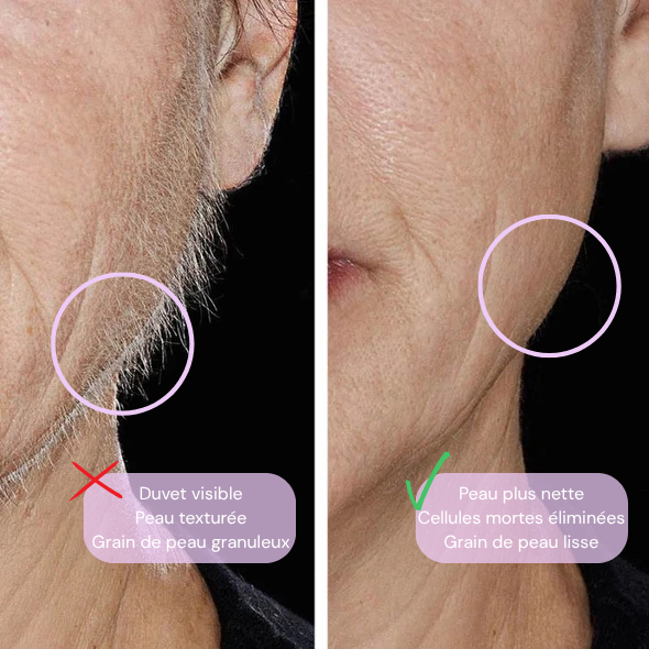 Dermaplaner rechargeable avec lumière LED intégrée